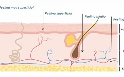 Beneficios del Peeling facial de invierno