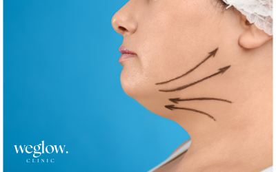 Endolifting: Liposucción sin cirugía en Benidorm