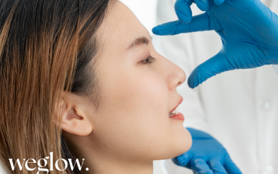 Rinomodelación con Ácido Hialurónico