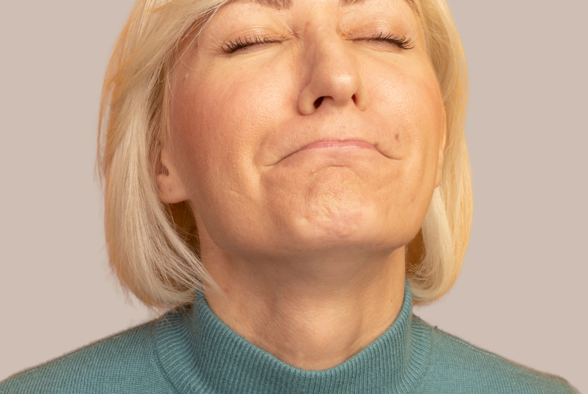 Mentón empedrado en Benidorm