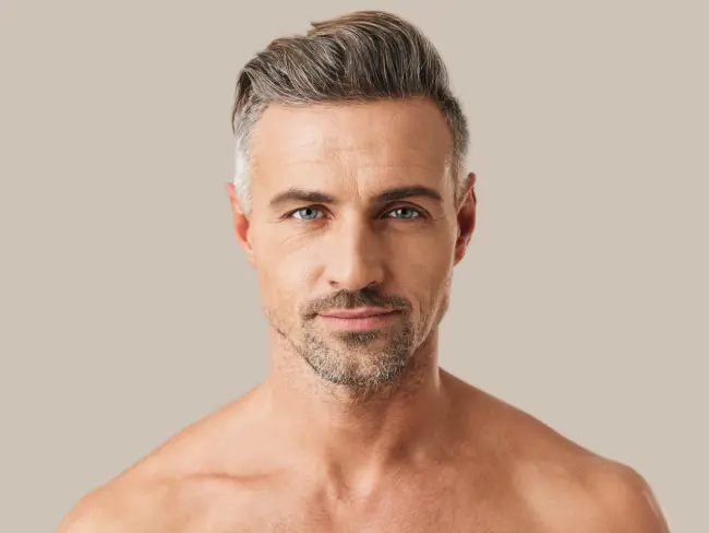 proyección de mentón