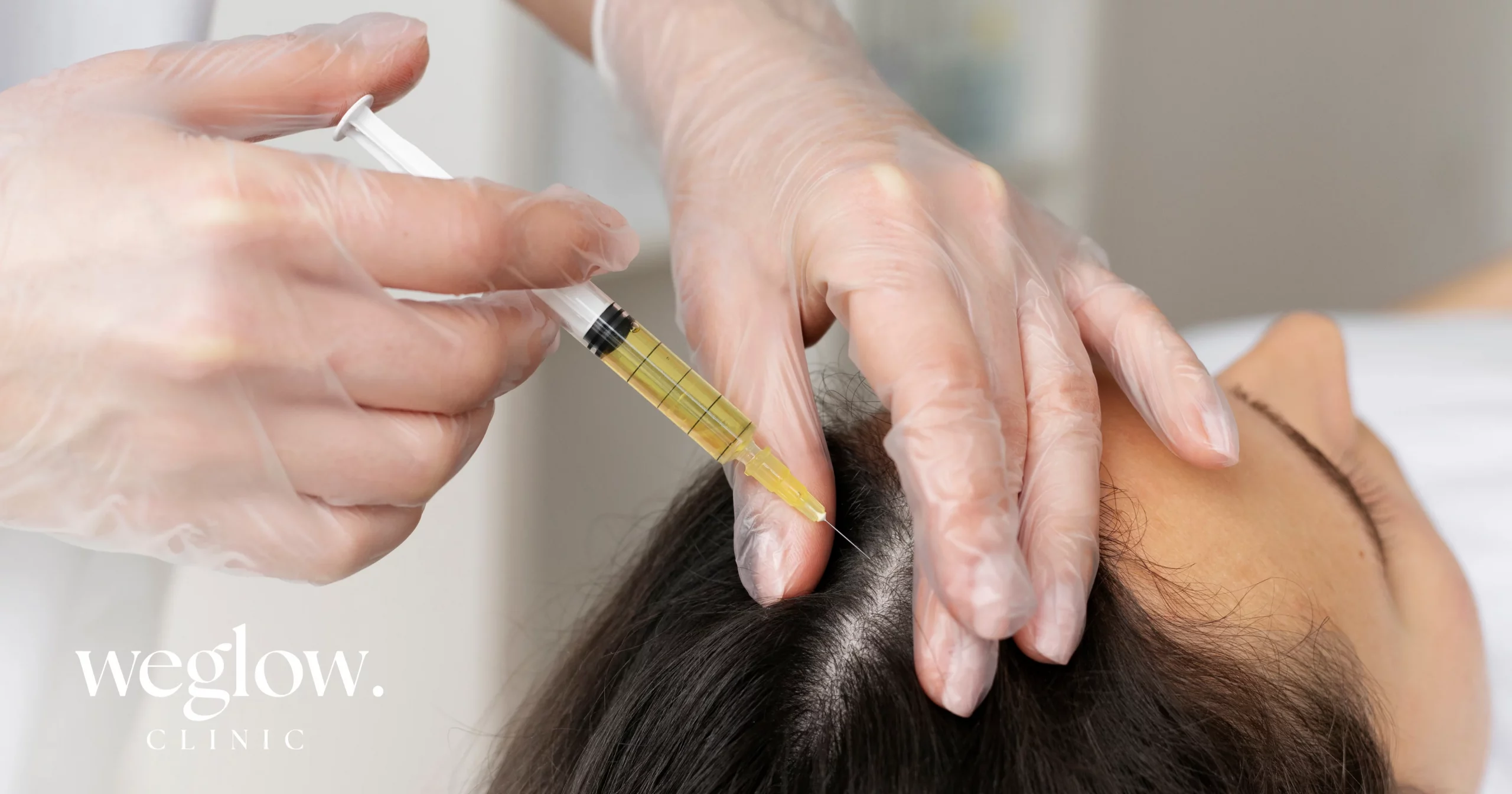 Mesoterapia capilar en benidorm