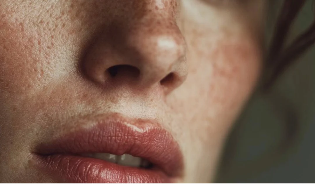 Aumento de labios en alicante