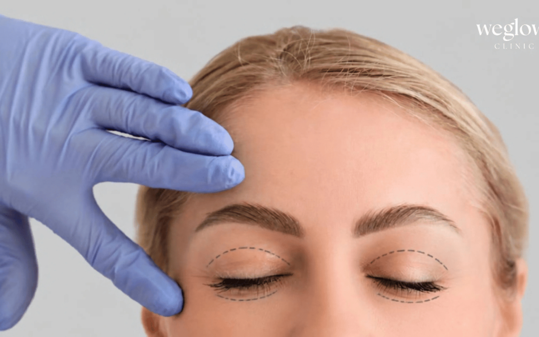 blefaroplastia sin cirugía en Alicante